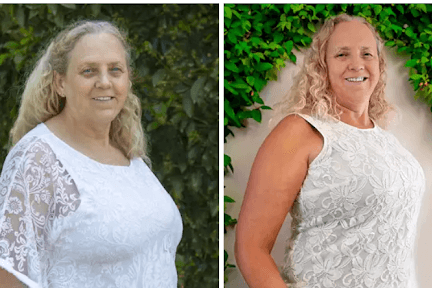 See the amazing before and after results of people who switched to a whole food plant-based diet!