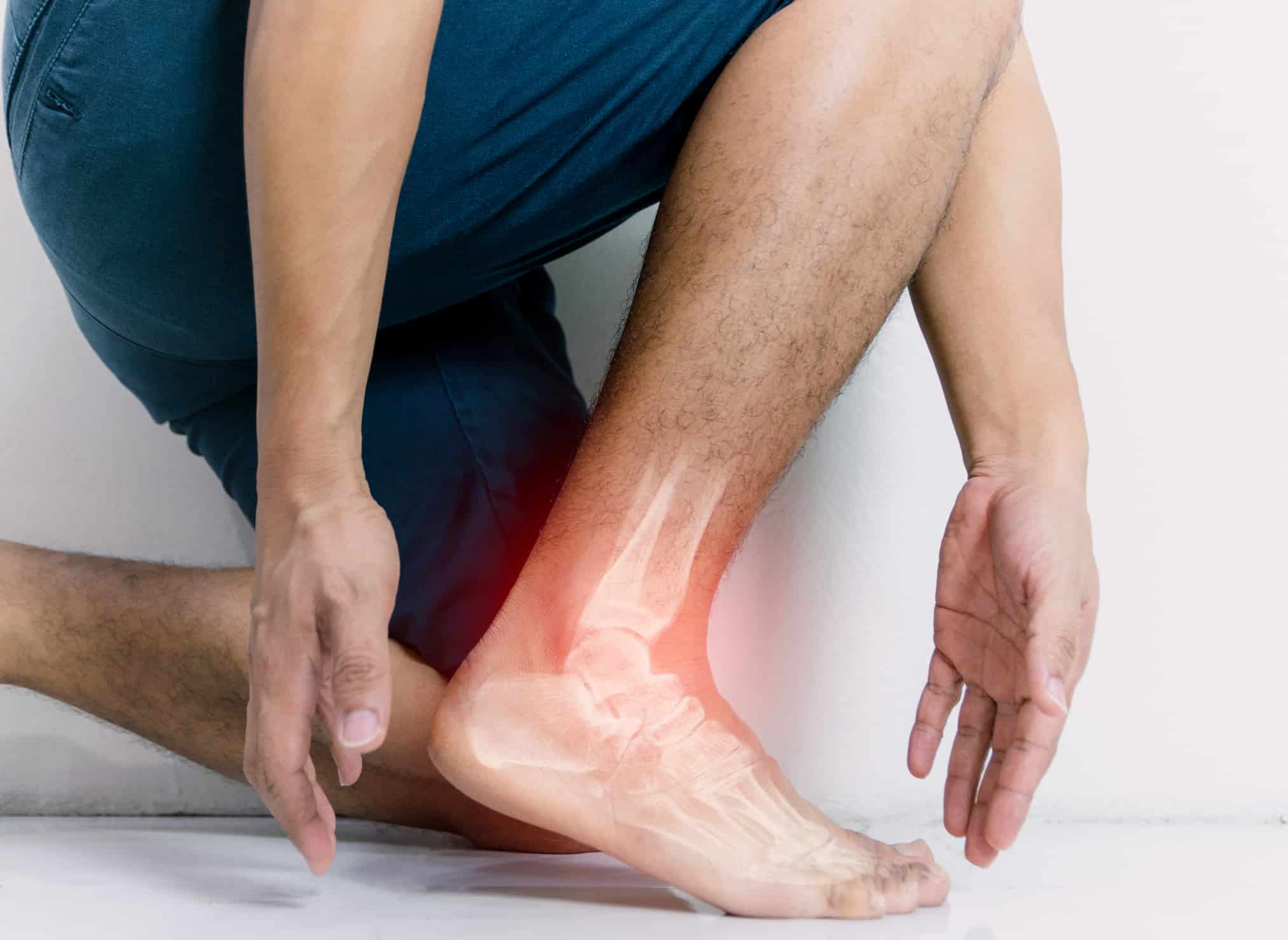 joint-inflammation-foot